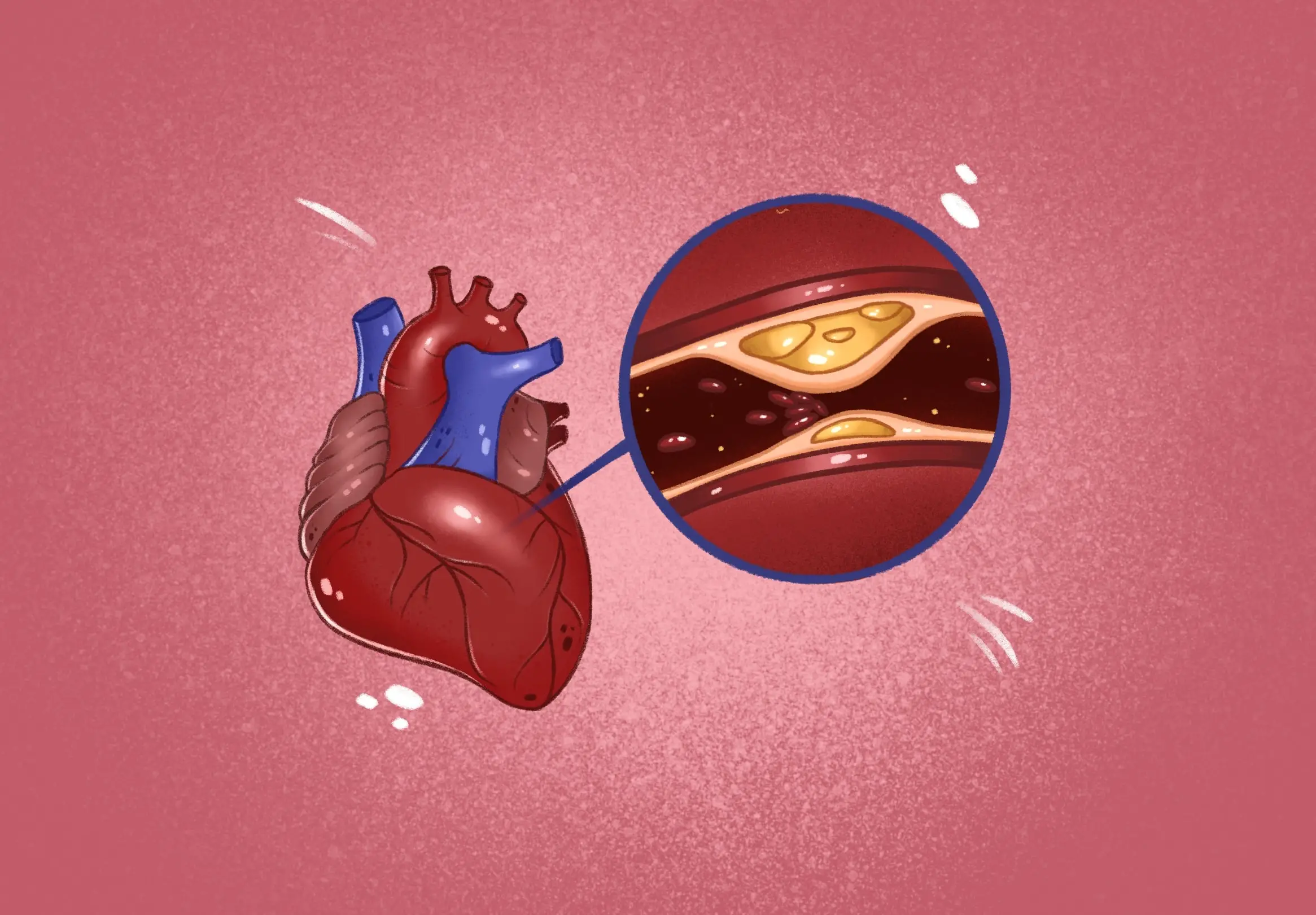 illustration